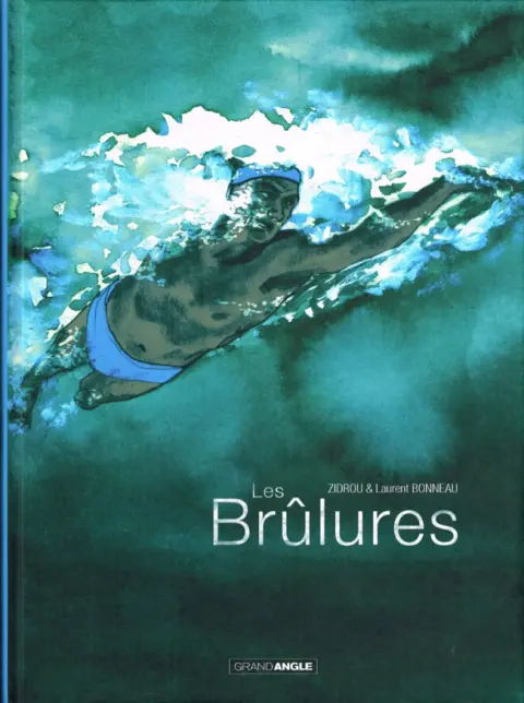 Les Brûlures